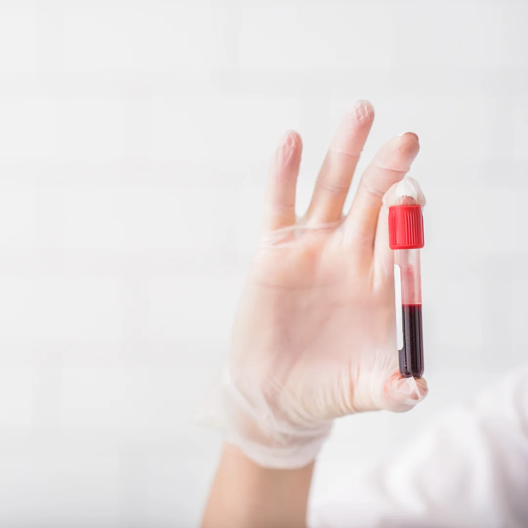 HSG Test (Hysterosalpingography) at Embrion IVF Vikhroli, Mumbai