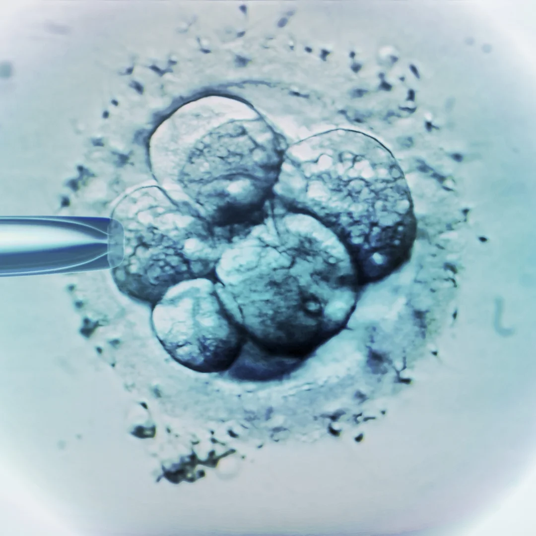 IUI Treatment (Intra-Uterine Insemination) at Embrion IVF Vikhroli, Mumbai