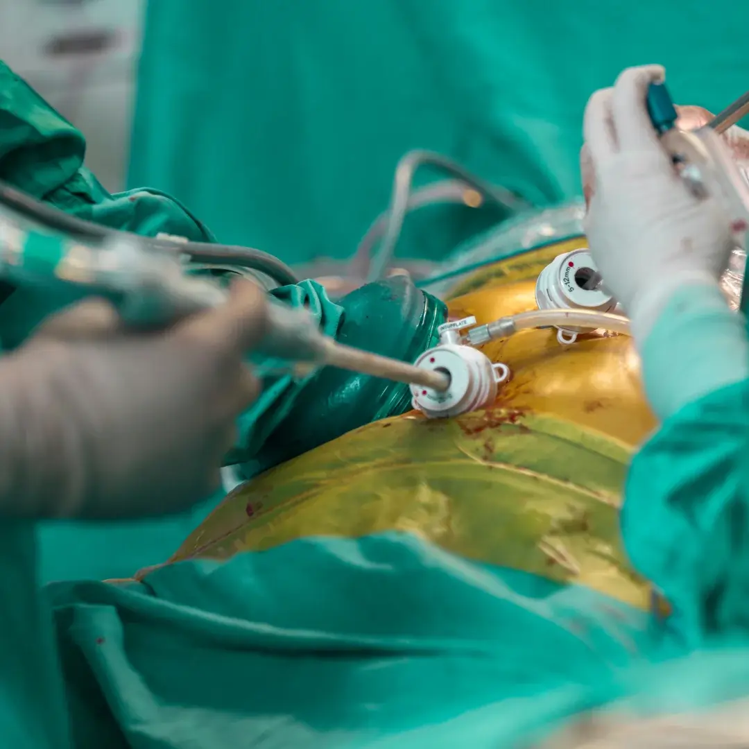 Laparoscopy at Embrion IVF Vikhroli, Mumbai